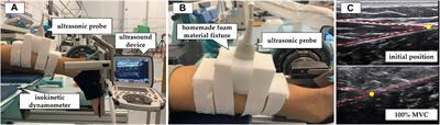 Morphological and viscoelastic properties of the Achilles tendon in the forefoot, rearfoot strike runners, and non-runners in vivo